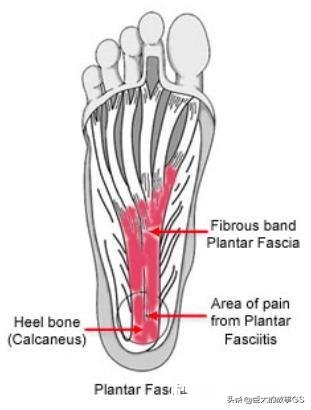 为什么打篮球刚开始大概十几分钟，脚底就感觉很酸没力，然后下场休息缓了一会就不会了，每次打球都这样