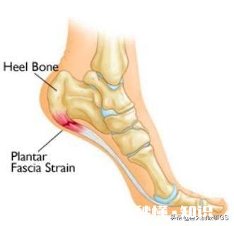为什么打篮球刚开始大概十几分钟，脚底就感觉很酸没力，然后下场休息缓了一会就不会了，每次打球都这样