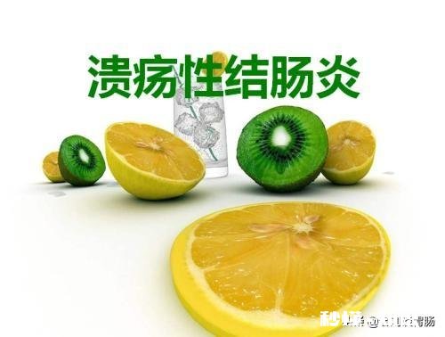 溃疡性结肠炎能活多久