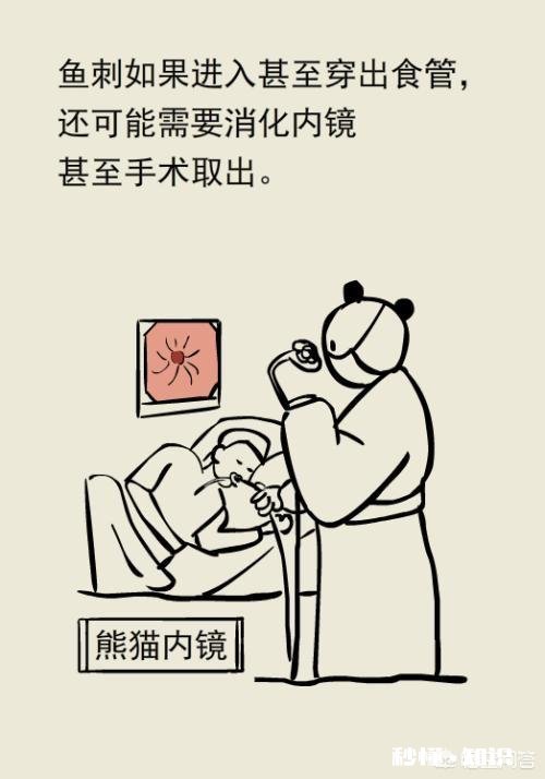 卡到鱼刺怎么办，在线等，很急