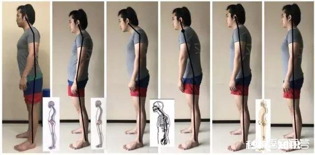 腰椎经常酸痛,请问有什么好的康复训练方法