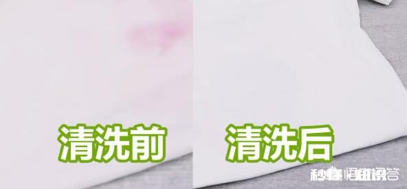 衣服发霉怎么洗掉黑斑