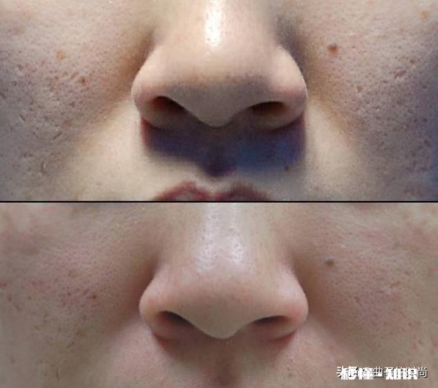 改变面部肌肤粗糙的方法有哪些