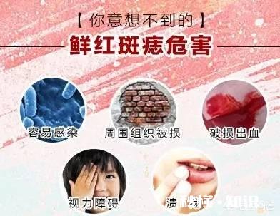 胎记是怎么形成的