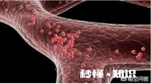 肾功不全的病人能吃海参及海产品吗