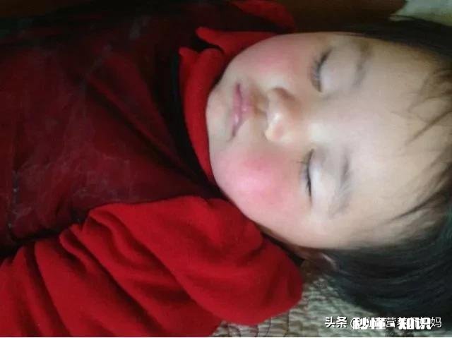 冬季宝宝的皮肤爱红、粗糙怎么办
