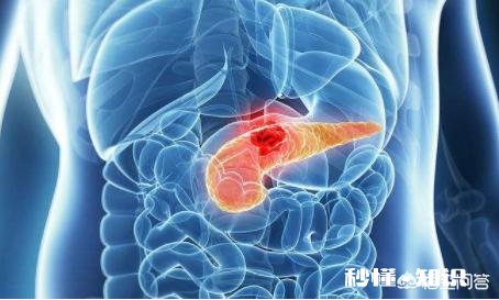 胰腺癌一般哪里会出现疼痛