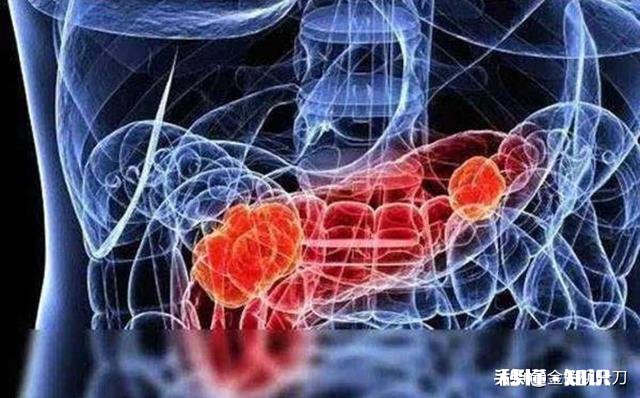 胰腺癌一般哪里会出现疼痛