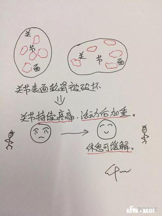 骨关节炎是冻出来的吗应该怎么办