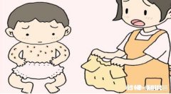 宝宝皮肤过敏要注意什么