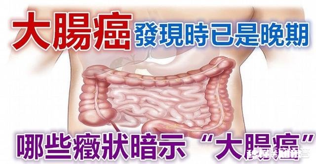 排便时出现哪些异常需要小心