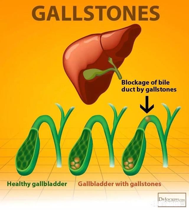 不吃早餐会怎样
