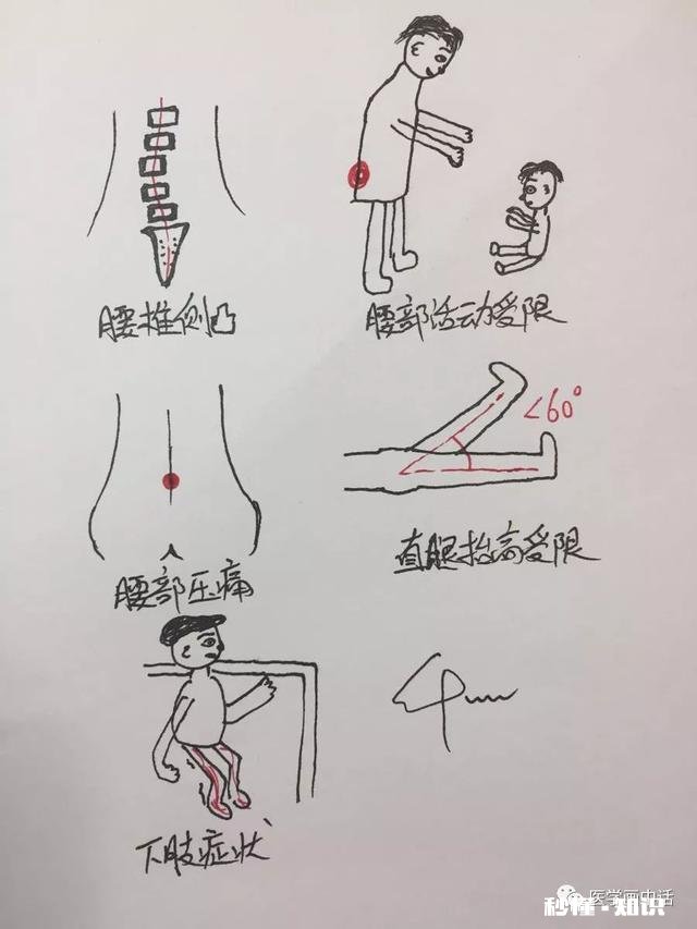 腰椎间盘突出怎么办