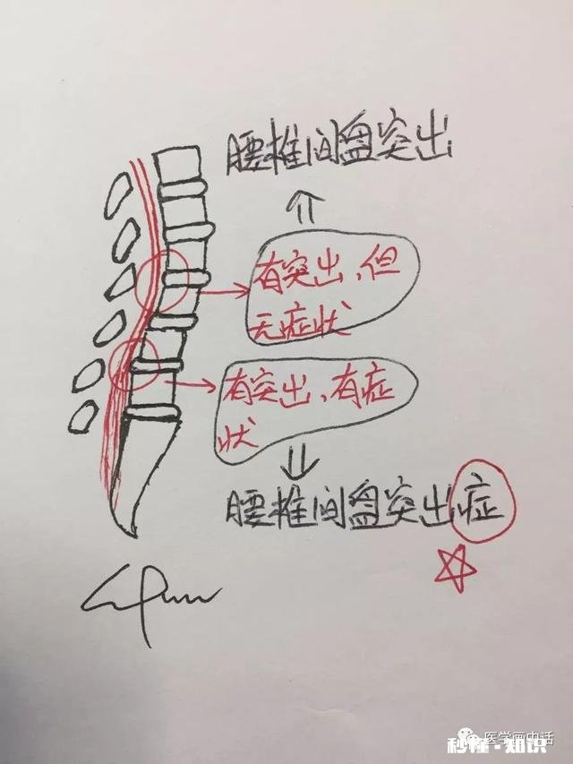腰椎间盘突出怎么办