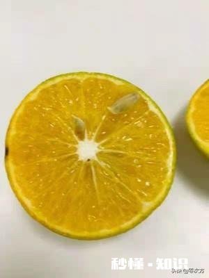 帕金森患者在生活中有哪些患病表现