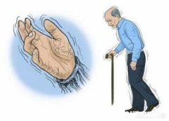 帕金森患者在生活中有哪些患病表现