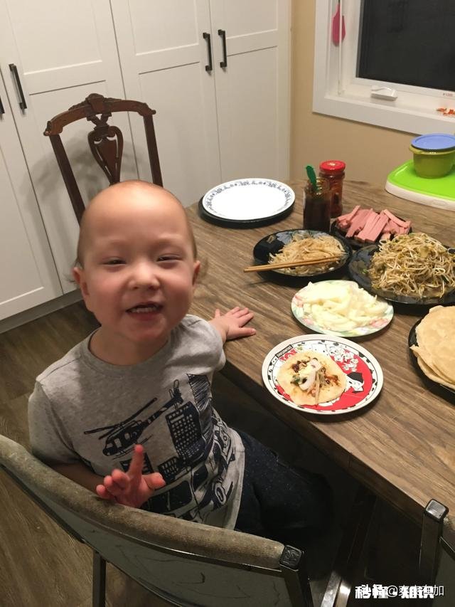 小孩牙齿发黑烂掉可以补吗怎么办