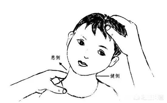 很多家长即使发现自家的孩子出现斜颈也不会十分重视吗