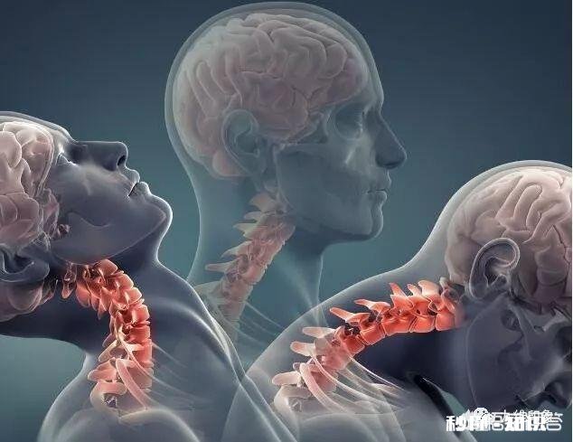 长时间坐着,导致颈椎越来越不好了,有解决的方法吗