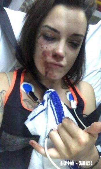 在美国黑人与白人游客发生嘴角，一群黑人围殴白人，为何会无人问津美国会南非化吗