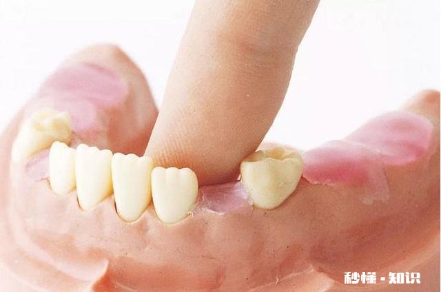 婴儿牙齿发黄是怎么回事