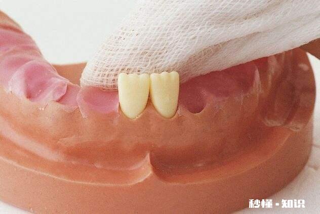 婴儿牙齿发黄是怎么回事