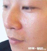 男生该怎样保养皮肤有什么好的产品值得推荐