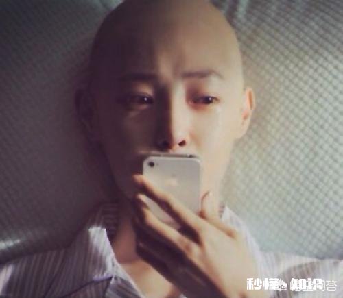 癌症病情应该先告知患者还是家属