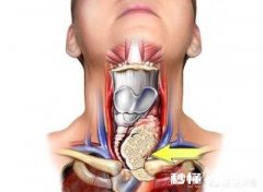 甲状腺癌早期会声音沙哑，如何预防甲状腺癌