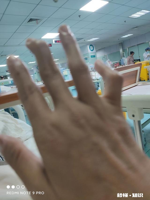 您认为不论什么原因，如果医生把你的亲人治死了，您会恨医生吗