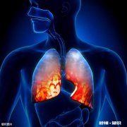 现在的新冠疫情，你觉得哪个国家会最先比中国更严重为什么