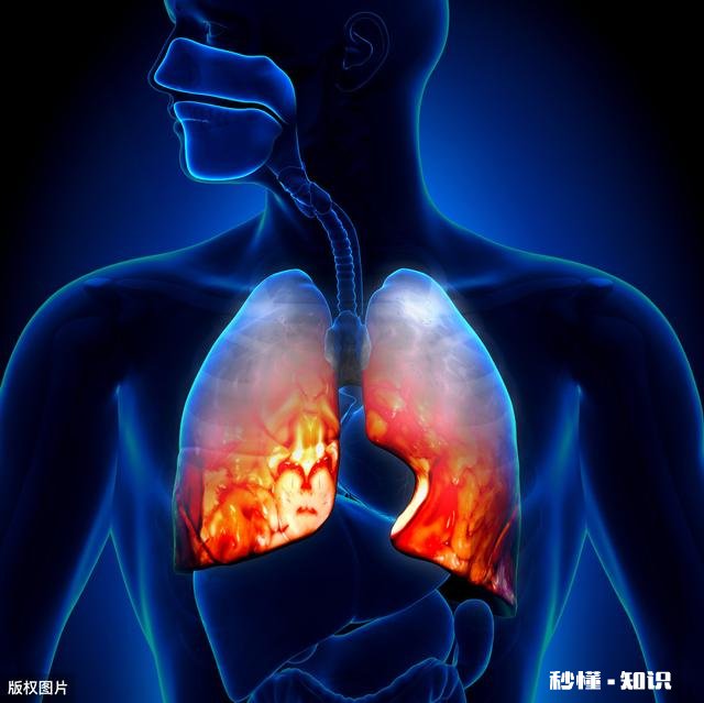 现在的新冠疫情,你觉得哪个国家会最先比中国更严重为什么