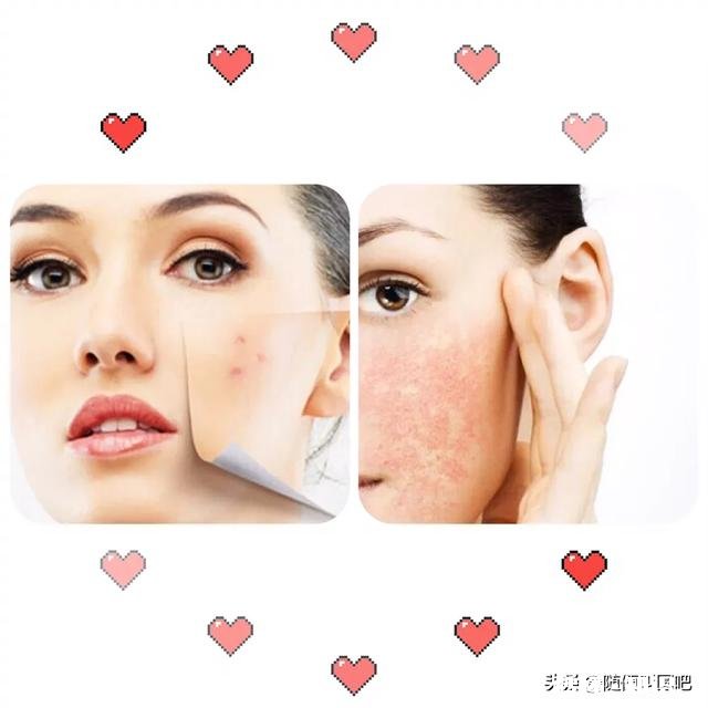 什么样的肌肤属于敏感肌敏感肌有哪些特征