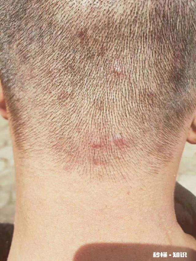 足疗店可以卖什么其他的附加产品