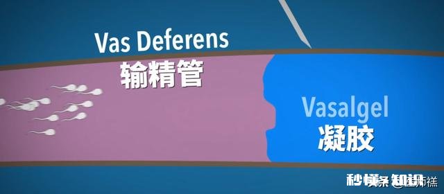 为什么不研发针对男性的避孕药