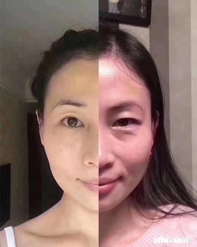 32岁,皮肤有些浮肿下垂,毛孔大,买了refa的按摩仪,效果不明显,用什么护肤品