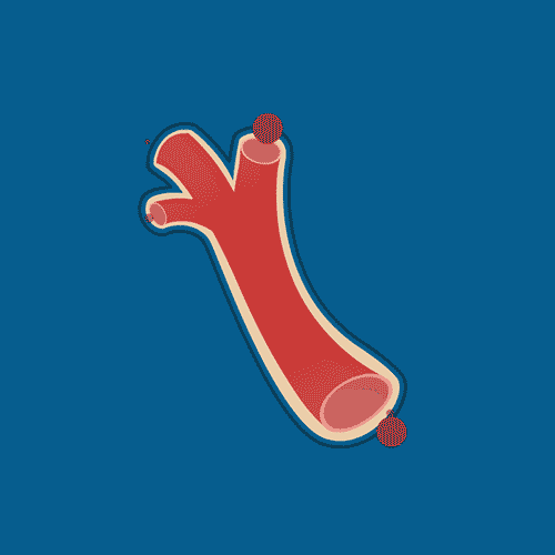 老人血管硬化吃什么