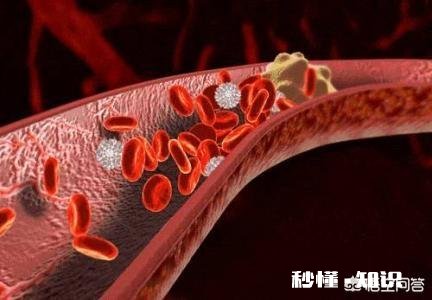 老人血管硬化吃什么