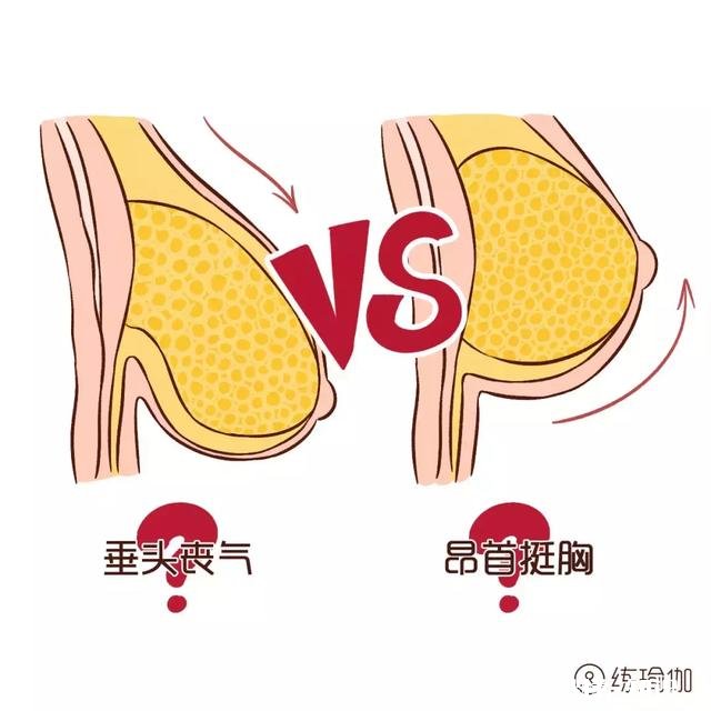 乳房下垂厉害，而且经常不舒服，该怎么办