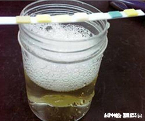 “脚部”出现哪些症状表明血糖可能已超标