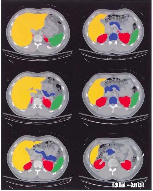 今天被小孩子问了一个雷人的问题，我怎么能知道自己的头有多重，求解