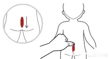 孩子大便干是体内缺水吗可以用小儿推拿调理吗