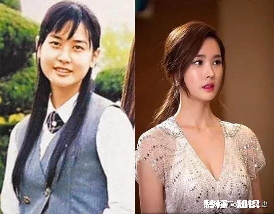 你对整形的看法是什么