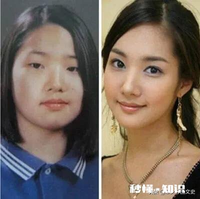 你对整形的看法是什么