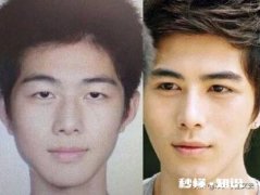 你对整形的看法是什么