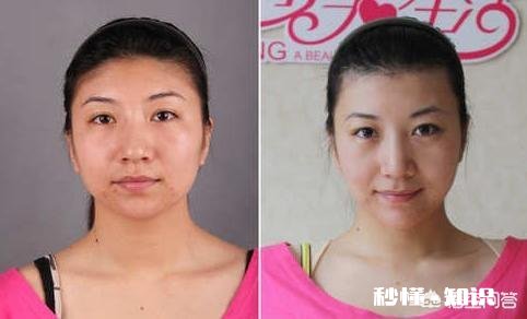 你对整形的看法是什么