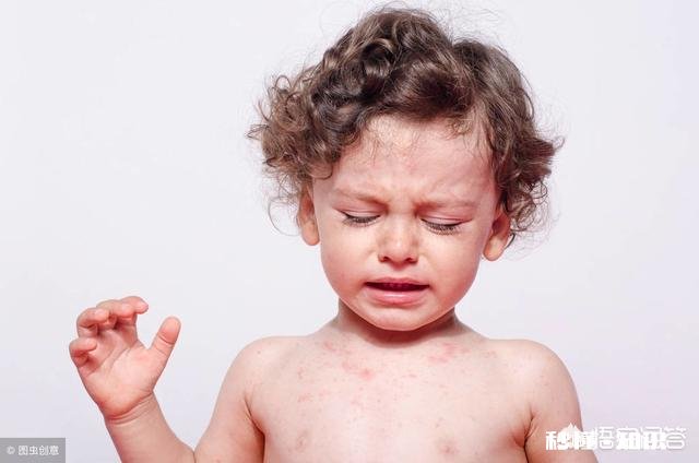 宝宝蛋白质过敏，有没有妈妈可以分享下经验