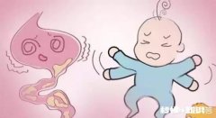 辅食添加时宝宝出现腹泻怎么办