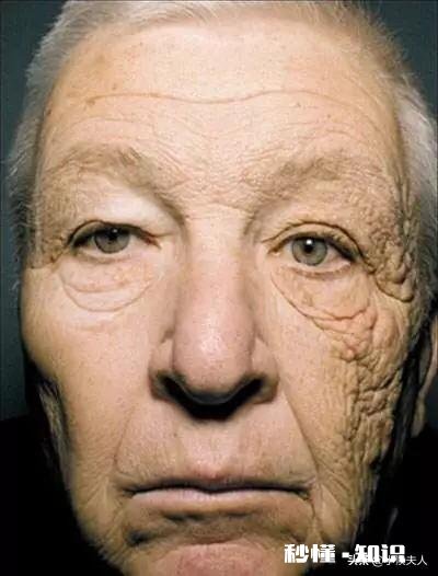 有必要天天用防晒霜吗