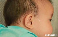 孩子出汗很厉害，是缺钙吗